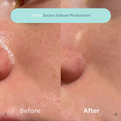 BLITHE PRESSED SERUM CRYSTAL ICEPLANT 50ML