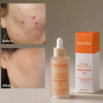 BLITHE TARGETED BLEMISH SERUM NIACINAMIDE 5.0 30ML