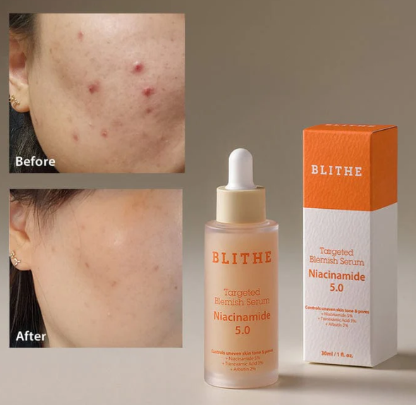BLITHE TARGETED BLEMISH SERUM NIACINAMIDE 5.0 30ML