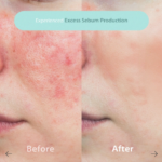 BLITHE PRESSED SERUM CRYSTAL ICEPLANT 50ML